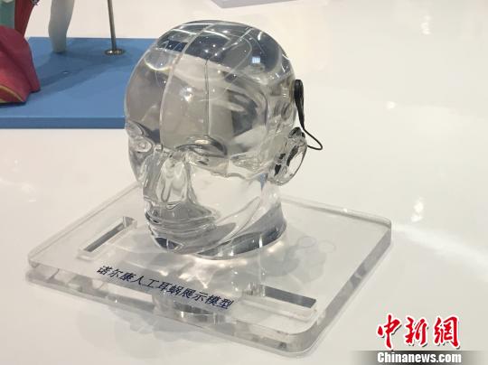 人工耳蜗展示模型。　钱晨菲 摄
